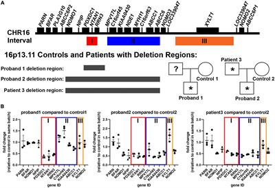 16p13.11 deletion variants associated with neuropsychiatric disorders cause morphological and synaptic changes in induced pluripotent stem cell-derived neurons